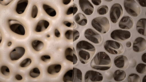 Why is Bone Density Important to Your Overall Health and How Can You Increase It?